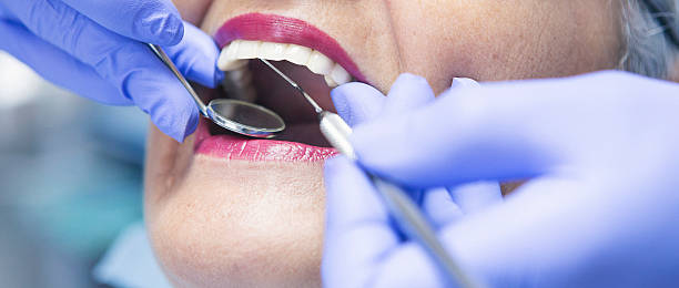 Best Emergency Dental Services for Seniors in Melbourne, FL
